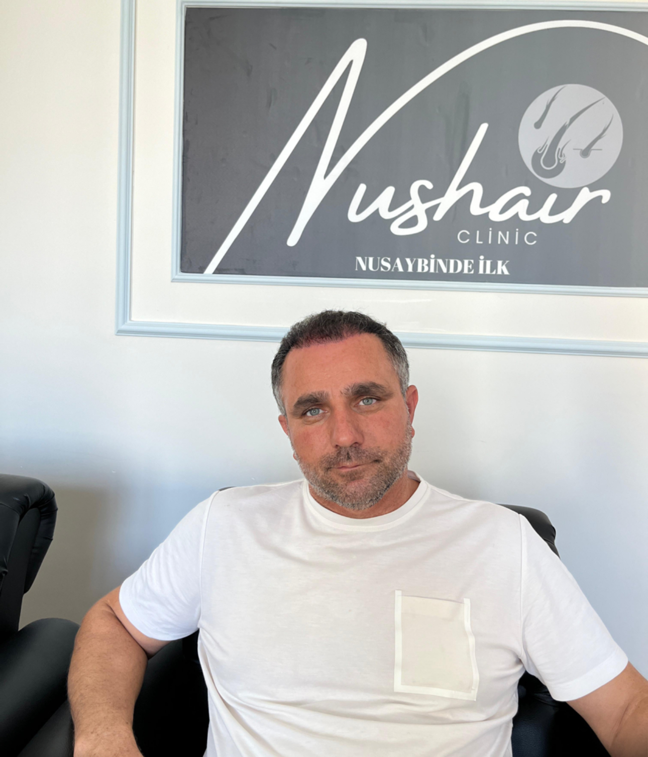 Nushair Klinik ile Hayalinizdeki Saçlara Kavuşun!